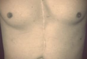Foto del pecho lleno de cicatrices del seductor global Sebastian Harris